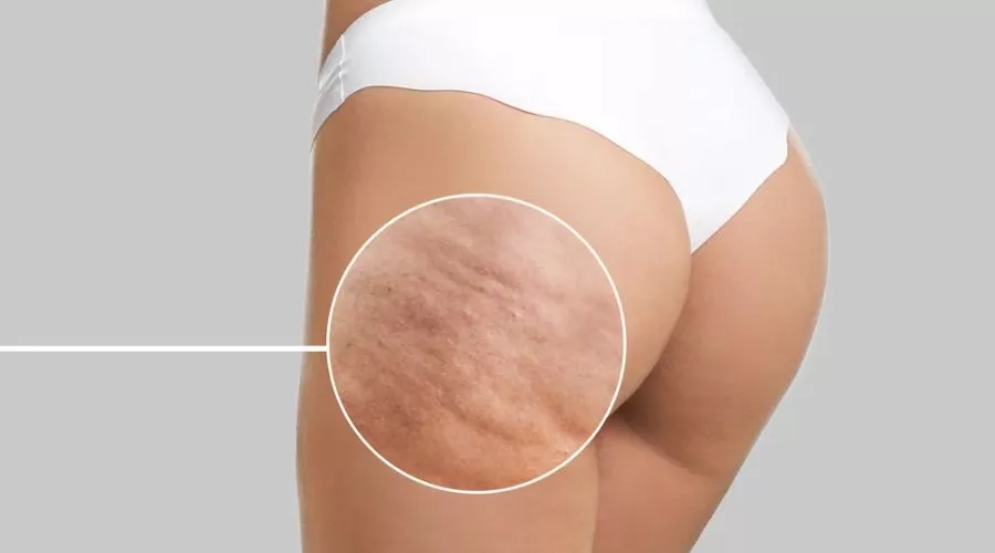 CelluCare Reviews | Findwyse